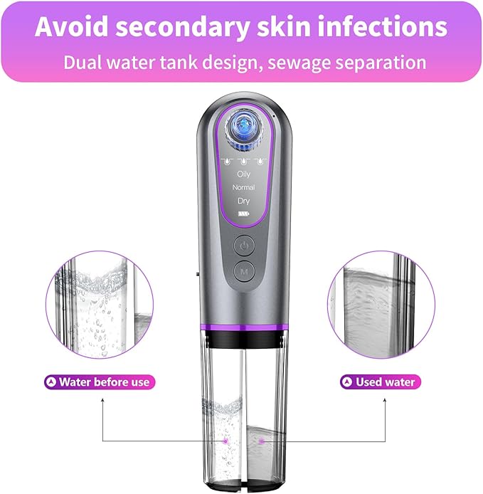 Blackhead Remover Vacuum with Microbubble Cleaning, Facial Pore Extractor & Pro Cleanser Tool, 3 Suction Levels, 5 Replaceable Heads for Deep Cleansing & Skin Care