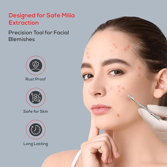 Suvorna Milia Remover, Milia Extractor, Acne Needle, Cyst Removal, Blackhead and Whitehead Removal, Pimple Popper Tool, Pimple Extractor, Blemish Remover Tool and Comedone Extractor.