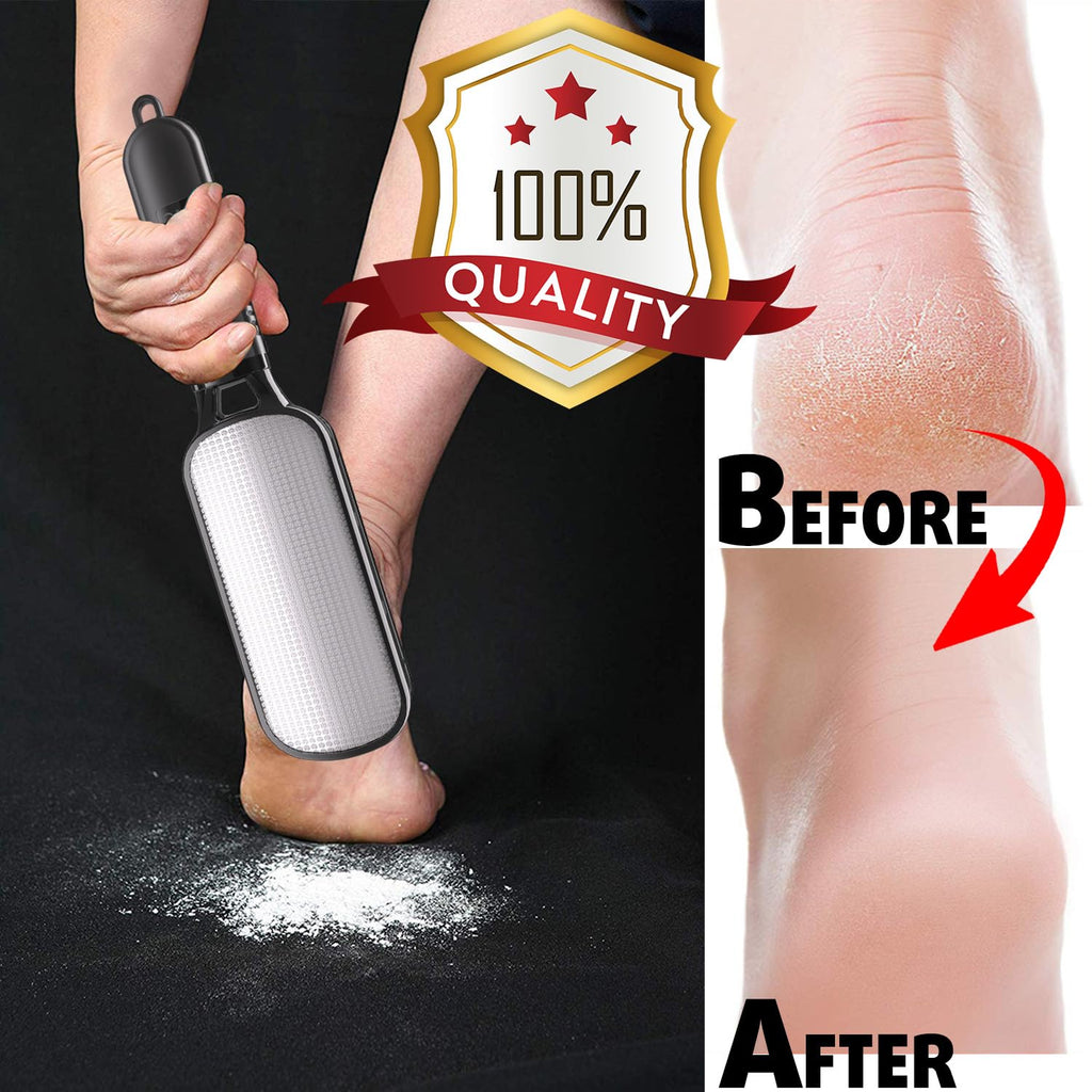 Antonki 2-in-1 Foot File Scrubber Feet Rasp for Dead Skin, Callus, Corn