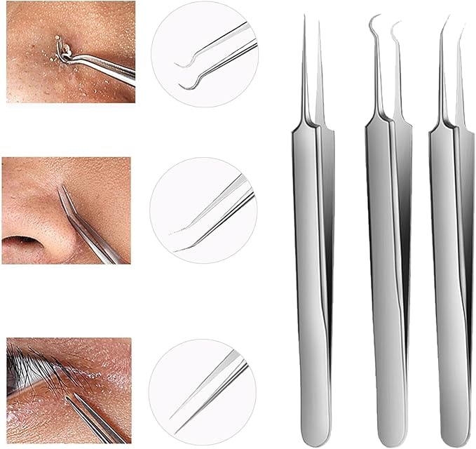WSYUB Blackhead Tweezers, Blackhead Extractor, Pimple Popper Tool Kit
