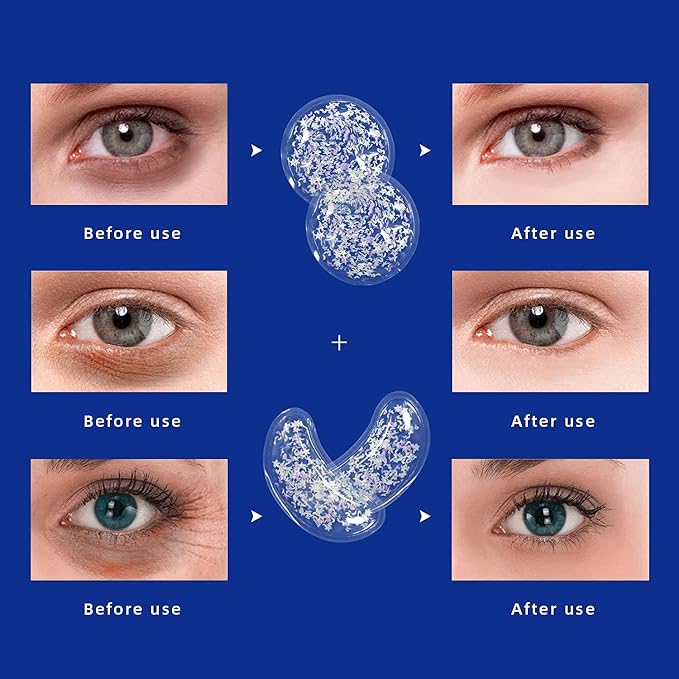 ZNÖCUETÖD Gel Ice Pack Reusable Cooling Eye Pads and Under Eye Patches,Eye Hot Cold Treatment Pack for Redness,Pain Relief and Eye Relax