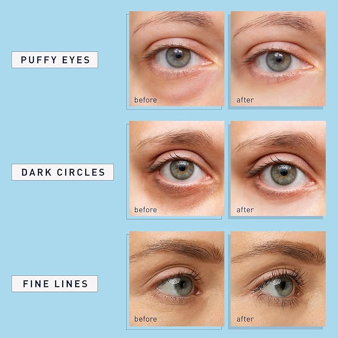 Under Eye Patches for Dark Circles: 30 Pairs Enaskin Naturals Retinol Collagen Eye Gels Mask - Reduce Wrinkles Puffy & Bags - Skin Treatment Pads - Anti Aging Moisturizer For Women (Blue)