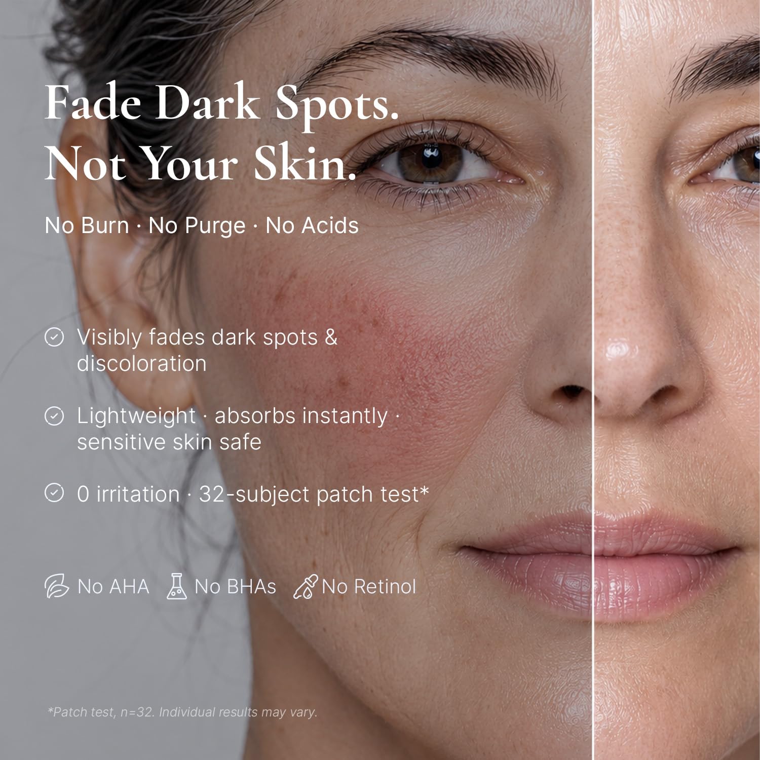 EnaSkin Dark Spot Corrector & Remover for Face & Body, 5% Tranexamic Acid