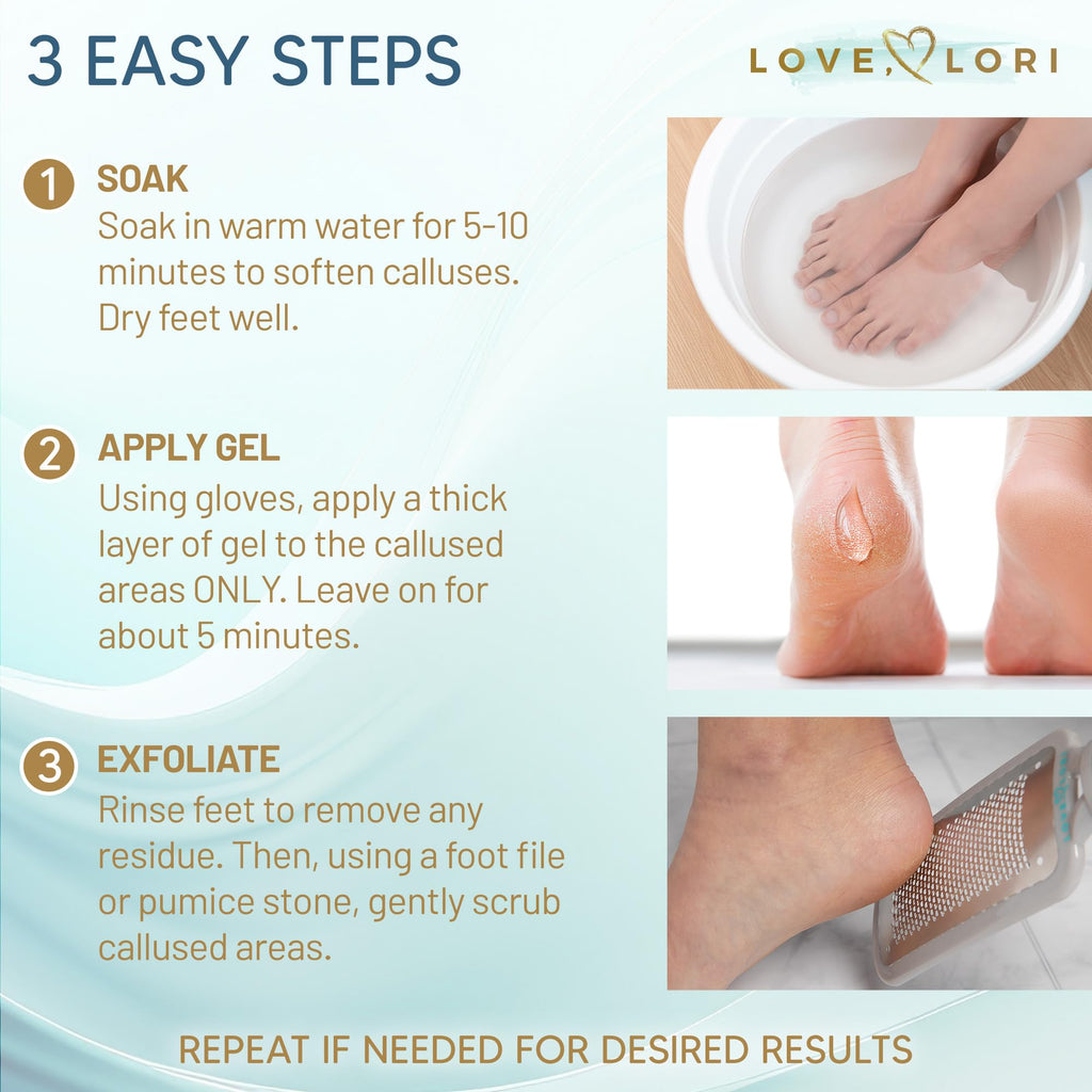 Love Lori Foot Callus Remover Kit - Gel & Foot Scraper for Dead Skin, 6oz
