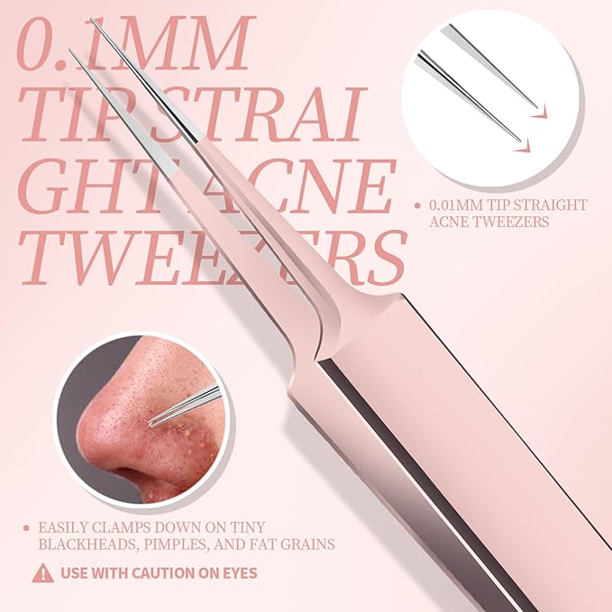 Teenitor Blackhead Remover Kit, Pimple Popper Tool Kit, 2 Blackhead Extractor, 1 Ingrown Hair Tweezers, 2 Pimple Extractor Pore Extractor Acne Tools for Face
