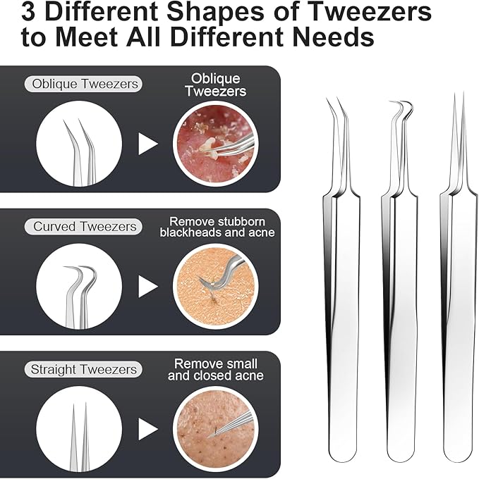 Meidaier 11Pcs Blackhead Remover Kit, Stainless Steel Acne Comedone Extractor with 10X Magnifying Glass & 20 75% Alcohol Pads, Pimple Whitehead Blemish Removal, Anti-Slip Handle & Storage Box
