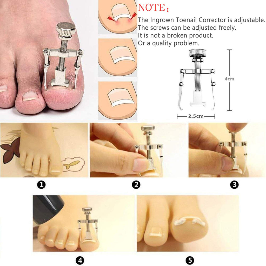 Ingrown Toenail Tool Ingrown Toenaill Clippers (9PCS), Professional Toe Nail Clipper Set for Ingrown & Thick Nail, Stainless Steel Ingrown Toenail Kit