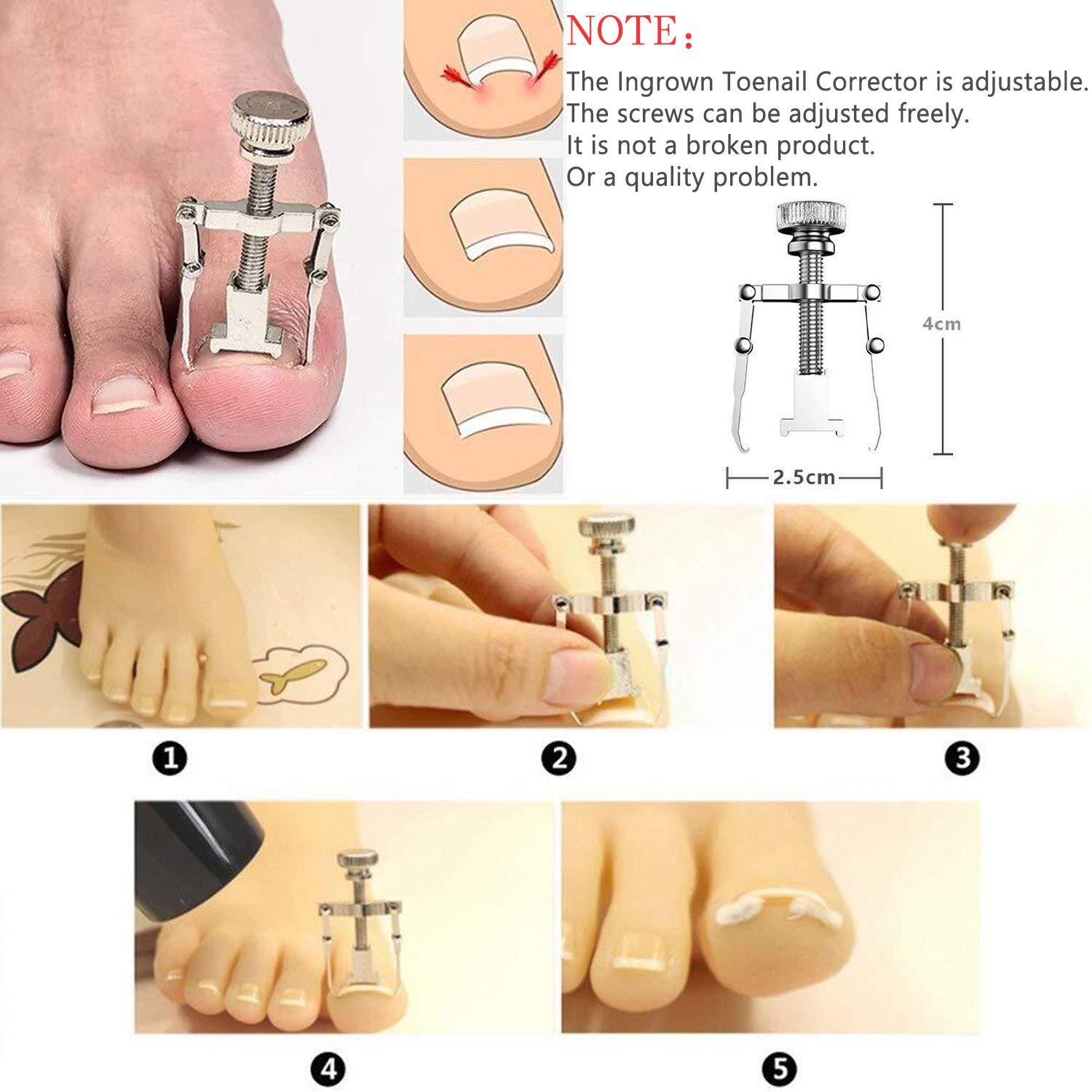 Ingrown Toenail Tool Ingrown Toenaill Clippers (9PCS), Professional Toe Nail Clipper Set for Ingrown & Thick Nail, Stainless Steel Ingrown Toenail Kit