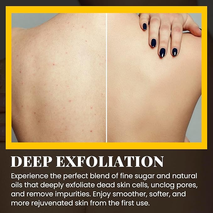 CHILLIHAER Turmeric Scrub For Dark Armpit Remover, Turmeric Body Exfoliator For Inner Thigh Dark Spots,Natural Glow Brightening Exfoliating Body Scrub,Cellulite Butt Sugar Scrub For Private Area