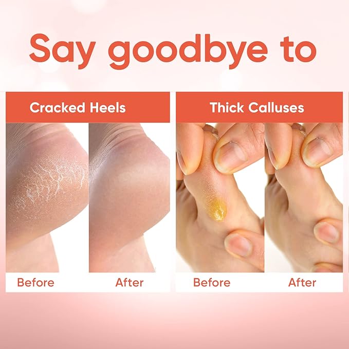 CÉLOR Foot Peeling Mask for Dry Cracked Feet | Foot Mask to Exfoliate Rough, Cracked, Dry Feet, Calluses for Soft Baby Feet Results | Made with Aloe Vera Extract for Women & Men (3 Pairs) | Peach