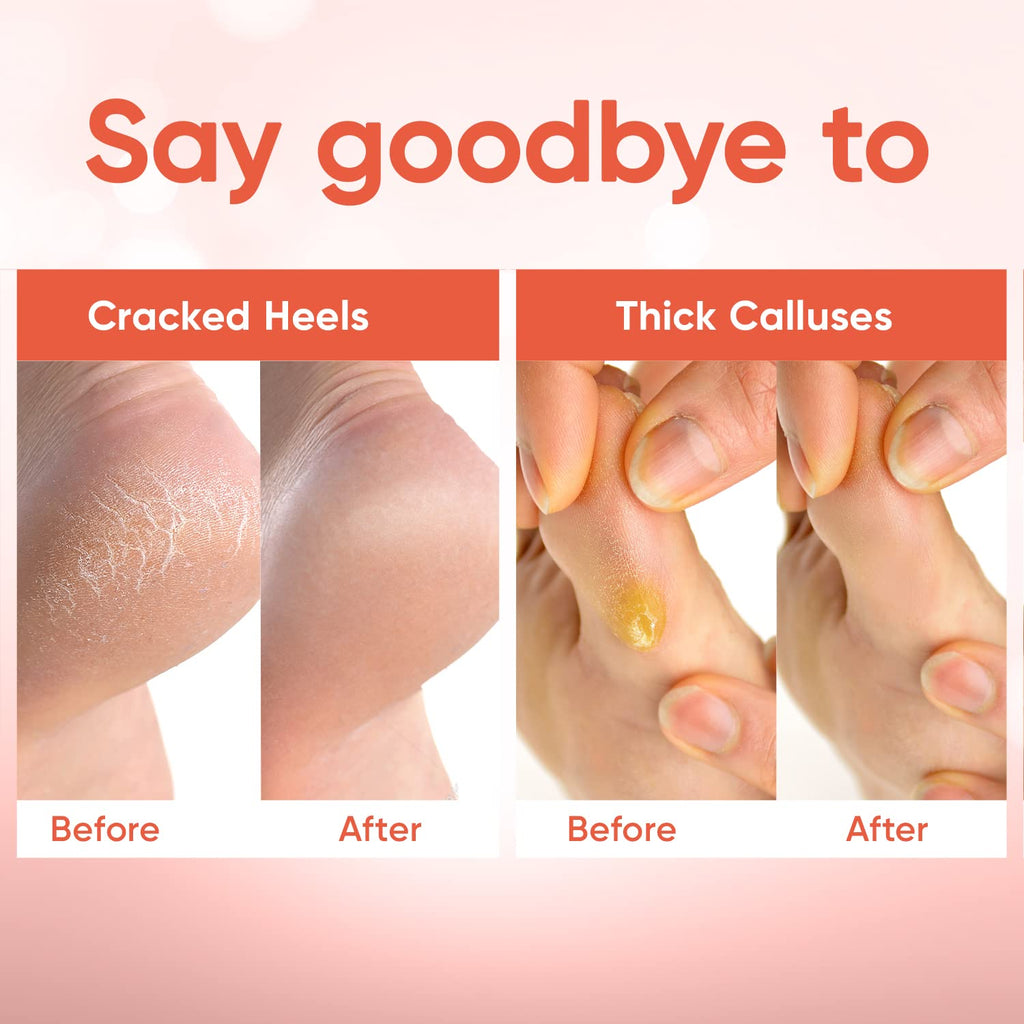CÉLOR Foot Peeling Mask for Dry Cracked Feet | Foot Mask to Exfoliate Rough, Cracked, Dry Feet, Calluses for Soft Baby Feet Results | Made with Aloe Vera Extract for Women & Men (5 Pairs) | Peach