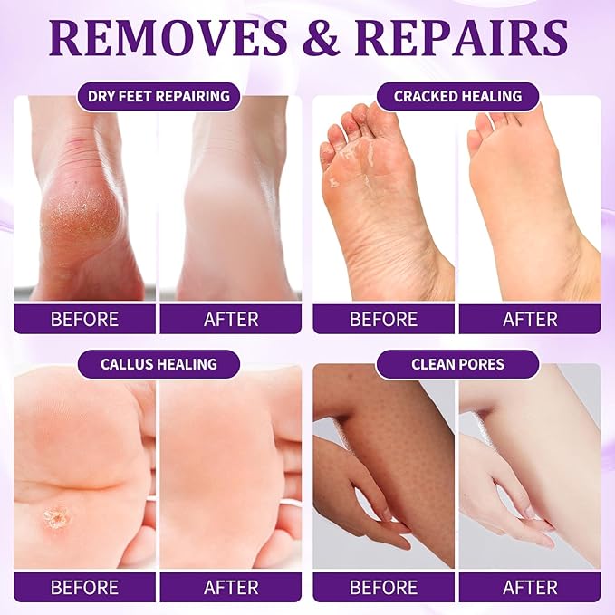 nbc BeautiLab Pedicure Kit Foot Soak Set: Bubble Salt, Sugar Scrub, Massage Mask, Massage Lotion in a Box, 4 Step Foot Spa Kit for Dry Feet, Softens Calluses, Tired Feet（3 Set Lavender)