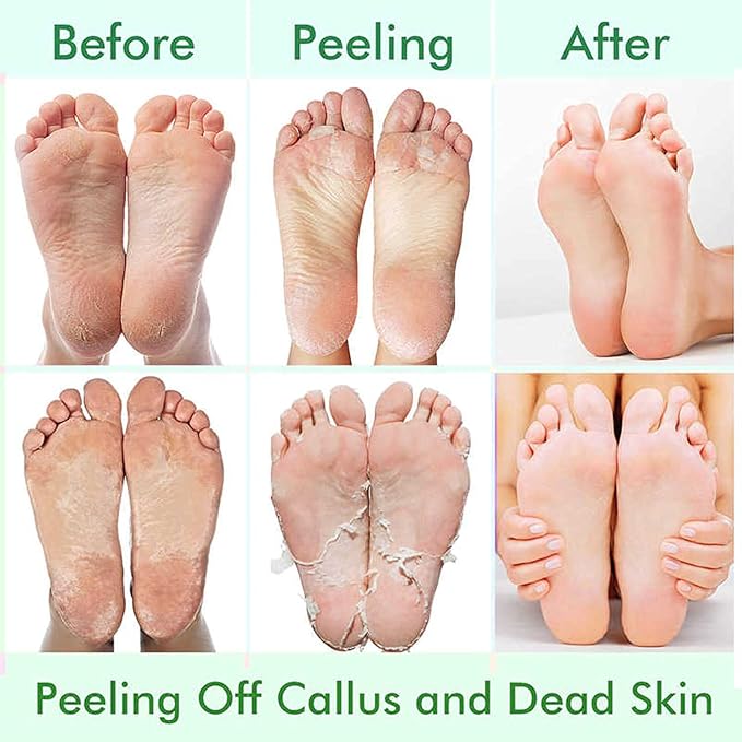 5 Pack Foot Peeling Mask,Exfoliator Peel Off Calluses Dead Skin Callus Remover,Foot Mask for Dry Cracked Feet,Foot Peel Masks for Men and Women Feet Peeling Mask for Fathers Day Gift,Gifts for Him