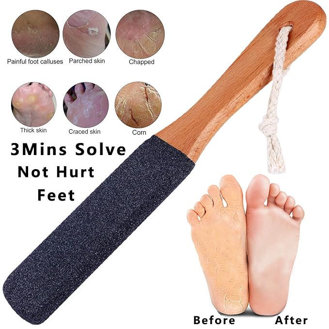 Kinepi Foot File & Foot Scrubber,Pumice Stone for Feet Callus Remover