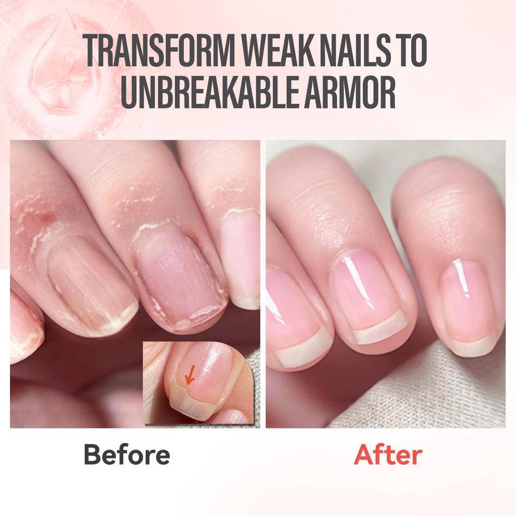 CHUCHU Vegan Cuticle Oil for Nails: Pomegranate Jojoba Nail Cuticle Oil with Vitamin B & E for Moisturizes Cuticle and Nail's Skin - Prevents Hangnails and Chapped 15ML