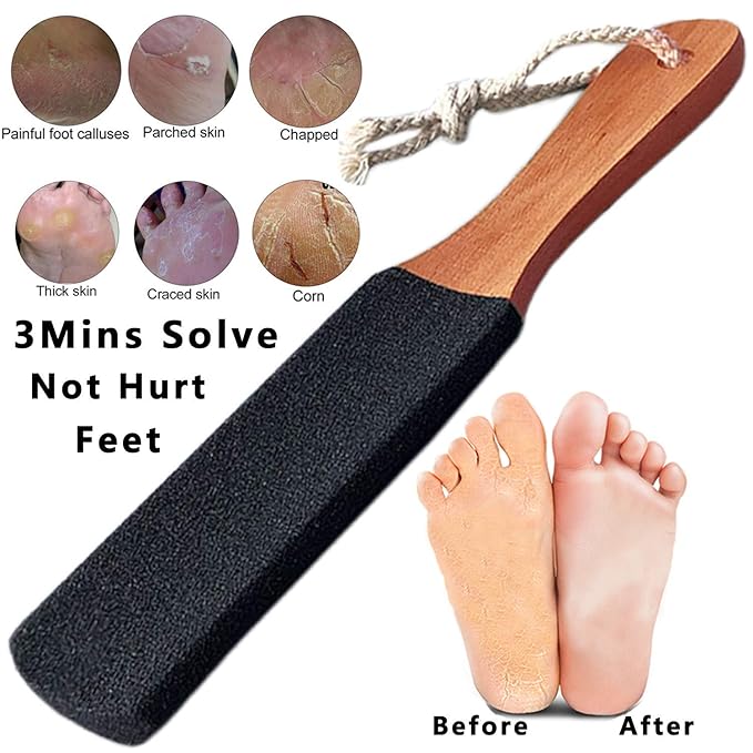 Kinepi Callus Remover Foot File & Foot Scrubber, Pumice Stone for Feet