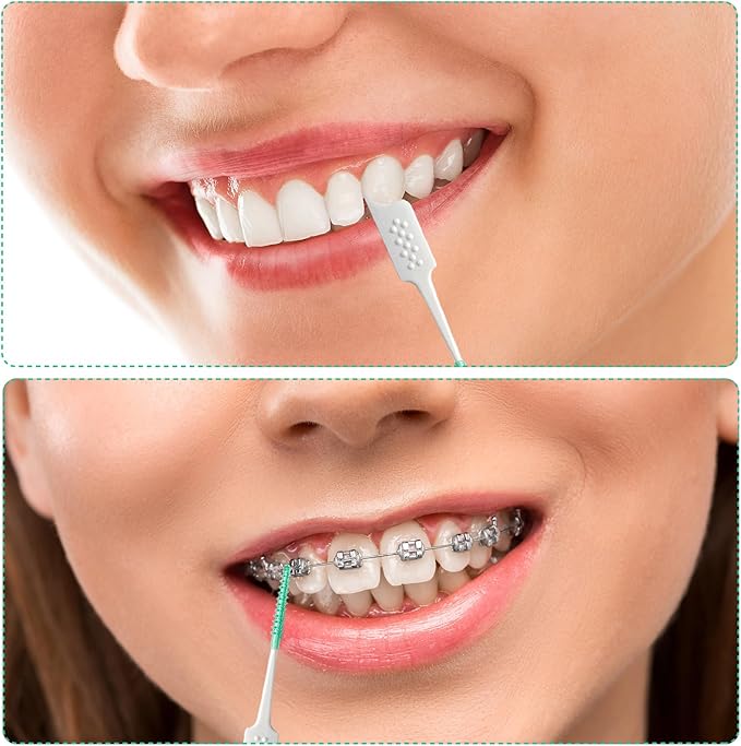 WQINX Dental Floss Picks Soft Silicone interdental Brush, Braces Brush, Floss Picks for Teeth, Disposable interdental Brush, Suitable for Cleaning Teeth Health(Green, 160pcs)