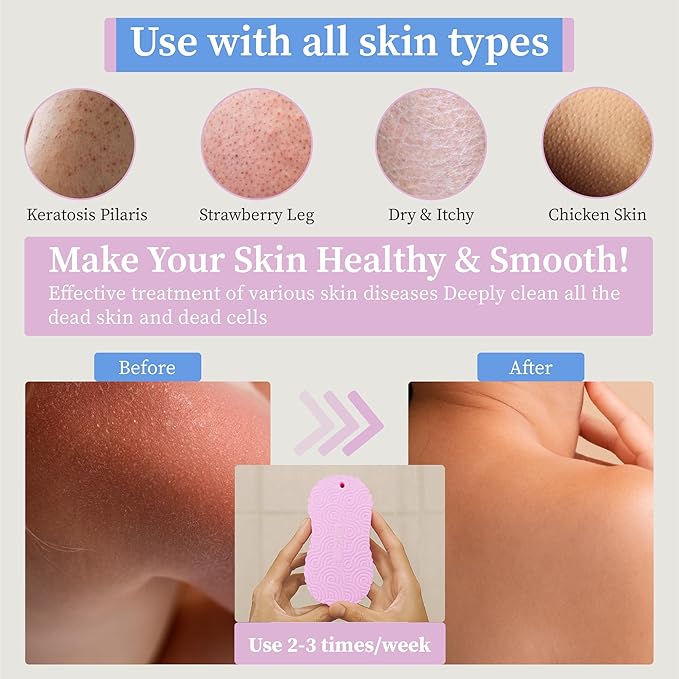 Magic Exfoliating Bath Sponge, 3D Super Soft Exfoliating Bath Sponge, Skin Friendly and Reusable for Adults Children and Pregnant Women Alternative to exfoliating Gloves (Blue + Pink)