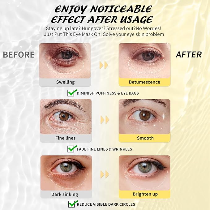 Maskiss Under Eye Patches (8 Pairs), Caffeine Eye Masks for Dark Circles Puffy Eyes Undereye Bags, Collagen Eye Patches for Wrinkles and Puffiness, Skin Care Gift for Her