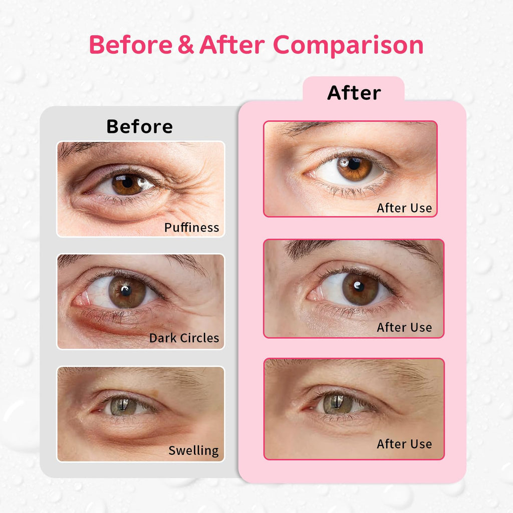 Conbella 4PCS Gel Eye Ice Pack Set Reusable, Cold and Hot Compress for Eyes