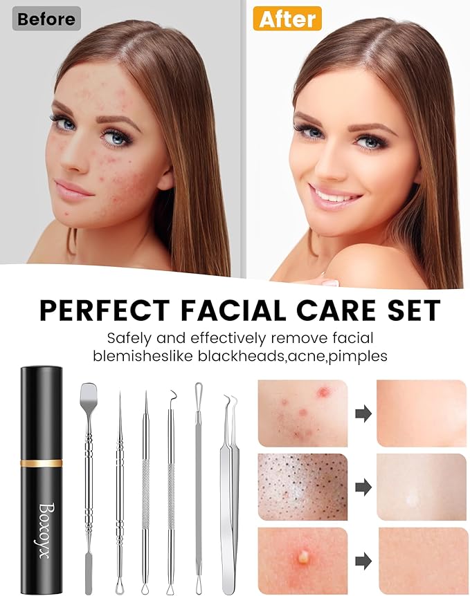 Pimple Popper Tool Kit - Boxoyx 6 Pcs Pore Prep Blackhead Remover Comedone Extractor Kit with Box for Quick and Easy Removal of Pimples, Blackheads, Zit Removing, for ehead,Facial and Nose (Silver)