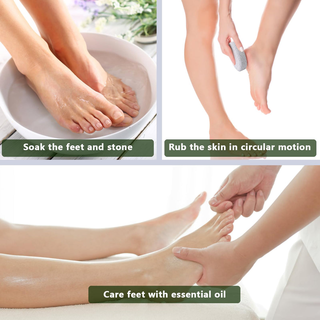 Natural Foot Pumice Stone for Feet, Borogo 2-Pack Lava Pedicure Tools Hard Skin Callus Remover for Feet and Hands - White