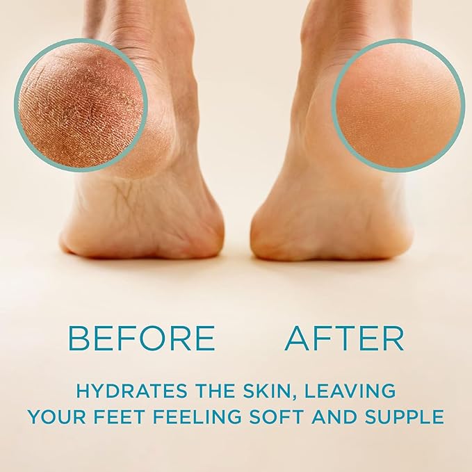 Lee Beauty 8oz Professional Gel Callus Remover for Feet - Original Fast-Acting Formula, Extra Strength for Cracked Heels & Dead Skin (Pack of 2)