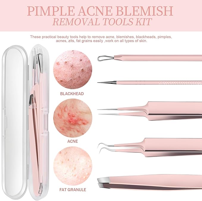 Teenitor Blackhead Remover Kit, Pimple Popper Tool Kit, 2 Blackhead Extractor, 1 Ingrown Hair Tweezers, 2 Pimple Extractor Pore Extractor Acne Tools for Face