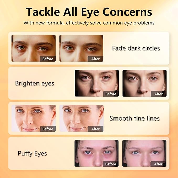 Aeryea Vitamin C & Caffeine Under Eye Patches for Men & Women 60 Pairs