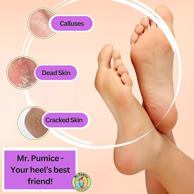 Mr. Pumice Purple PUMI Bar - Extra-Coarse Pumice Stone for Feet Callus Remover Pedicure Tools for Feet Foot Scrubber Skin Exfoliator Block, 4 Pack