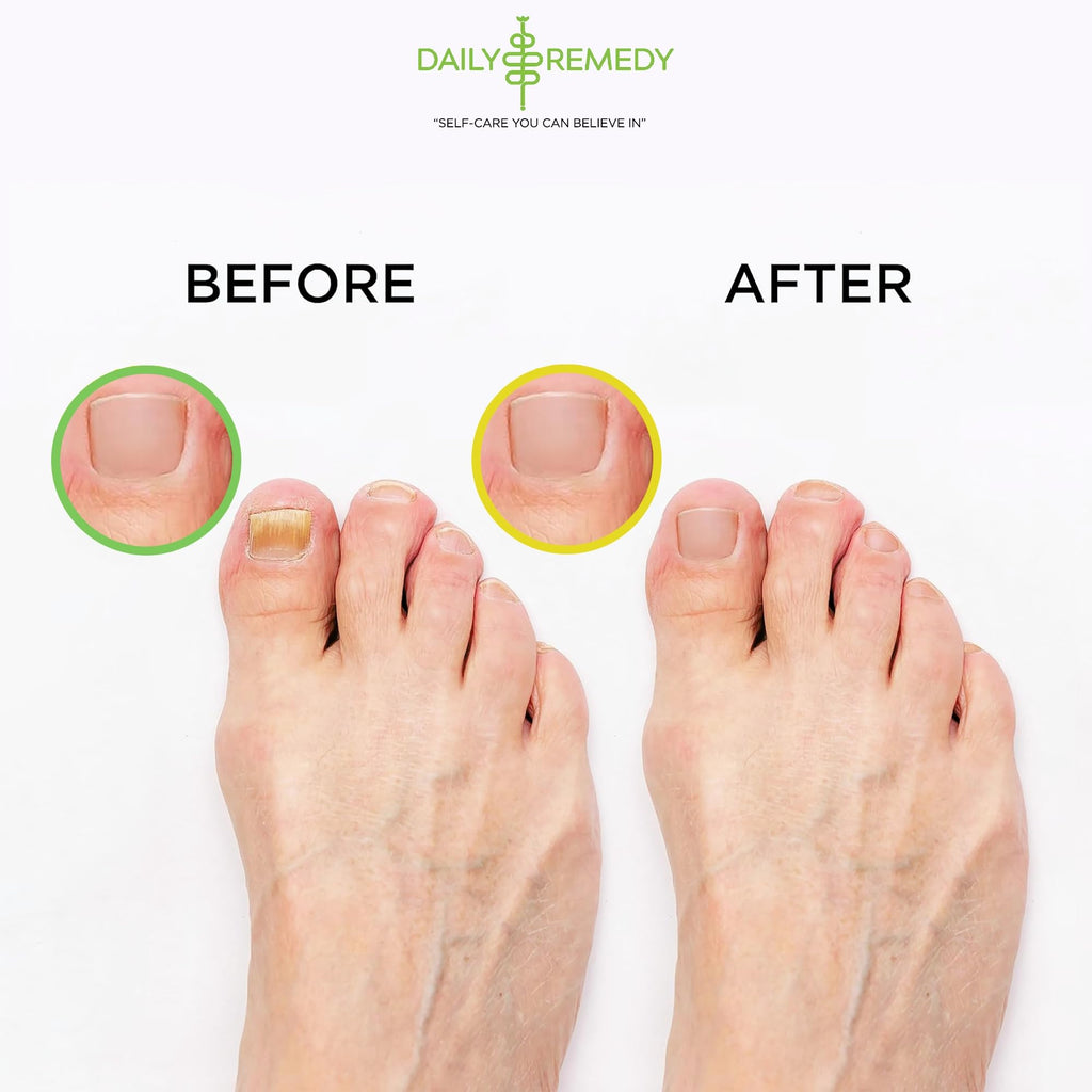 DAILY REMEDY EXTRA STRENGTH Tea Tree Oil & Citrus Detox Foot Soak Set - Made in USA - Soothes Sore Tired Feet, Athletes Foot, Stubborn Foot Odor, Softens Calluses & Refreshes & Detoxifies - Pack of 2