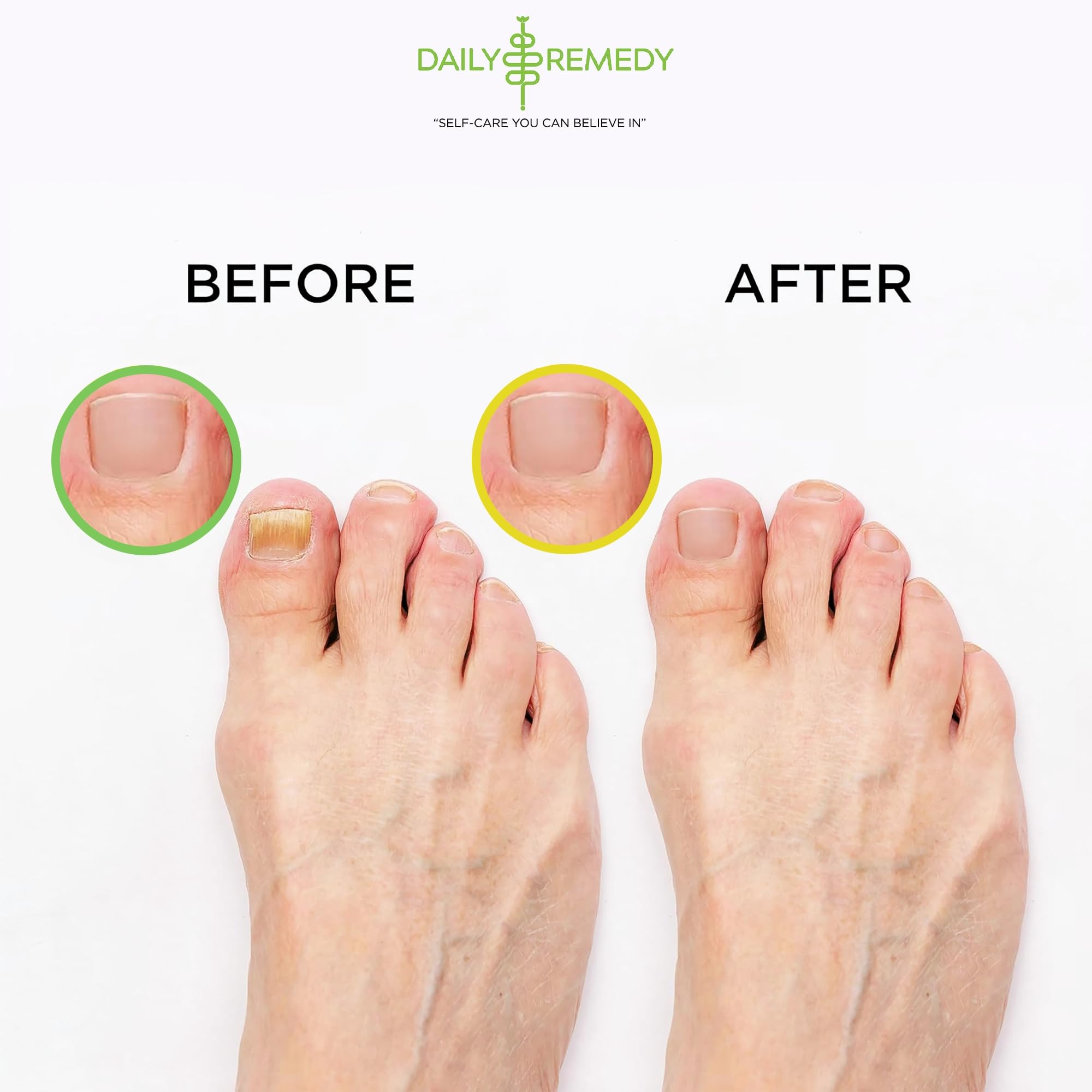 DAILY REMEDY EXTRA STRENGTH Tea Tree Oil & Citrus Detox Foot Soak Set - Made in USA - Soothes Sore Tired Feet, Athletes Foot, Stubborn Foot Odor, Softens Calluses & Refreshes & Detoxifies - Pack of 2