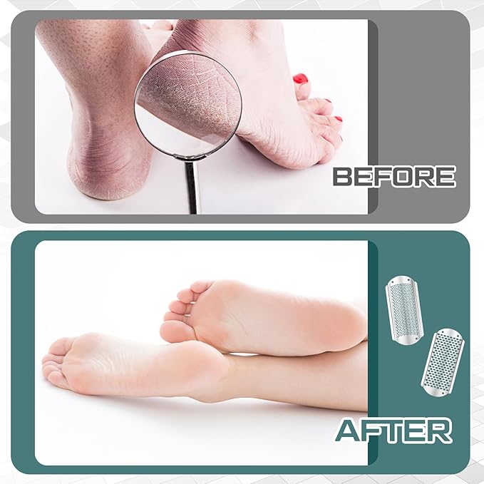 Moxweyeni 8 Pack Silver Foot File Callus Remover Replacement Blades Metal Pedicure Rasp Hard Skin Remove Scrubber Stainless Steel 2 Designs Big/fine Hole for Detachable Foot Grater