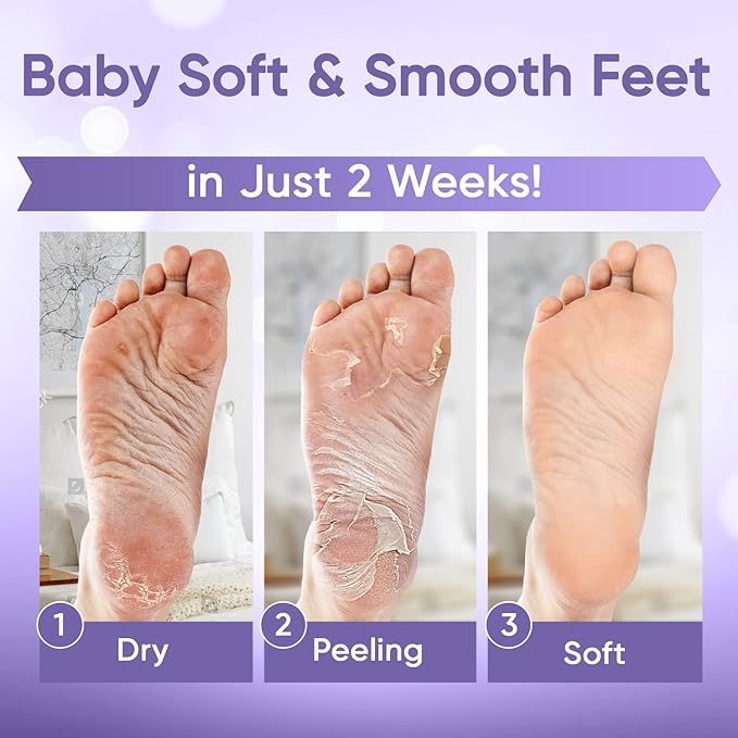 CÉLOR Foot Peeling Mask for Dry Cracked Feet | Foot Mask to Exfoliate Rough, Cracked, Dry Feet, Calluses for Soft Baby Feet Results | Made with Aloe Vera Extract for Women & Men (5 Pairs) | Lavender
