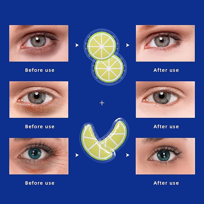 ZNÖCUETÖD Gel Ice Pack Reusable Cooling Eye Pads and Under Eye Patches,Eye Hot Cold Treatment Pack for Redness,Pain Relief and Eye Relax