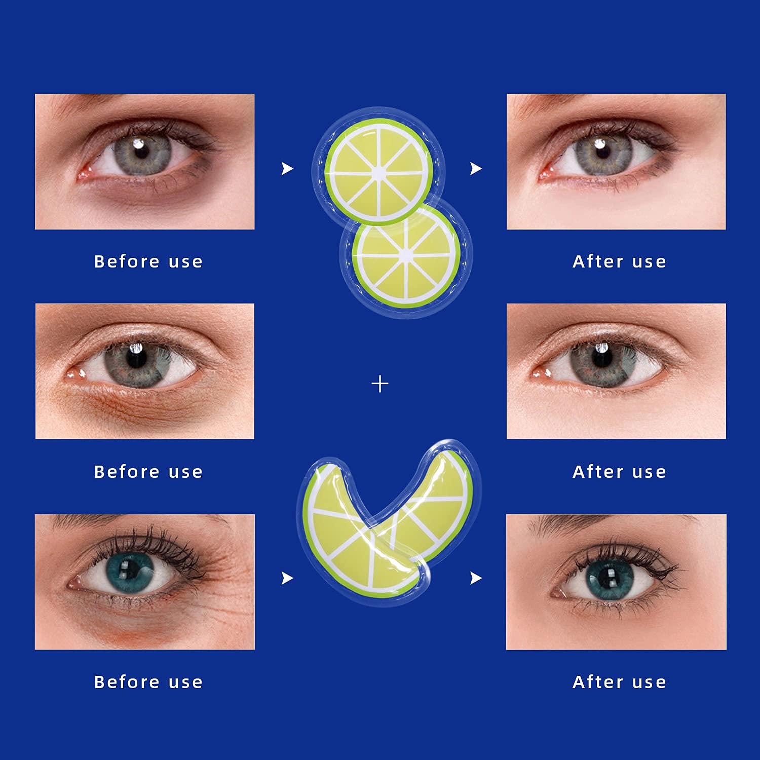 ZNÖCUETÖD Gel Ice Pack Reusable Cooling Eye Pads and Under Eye Patches