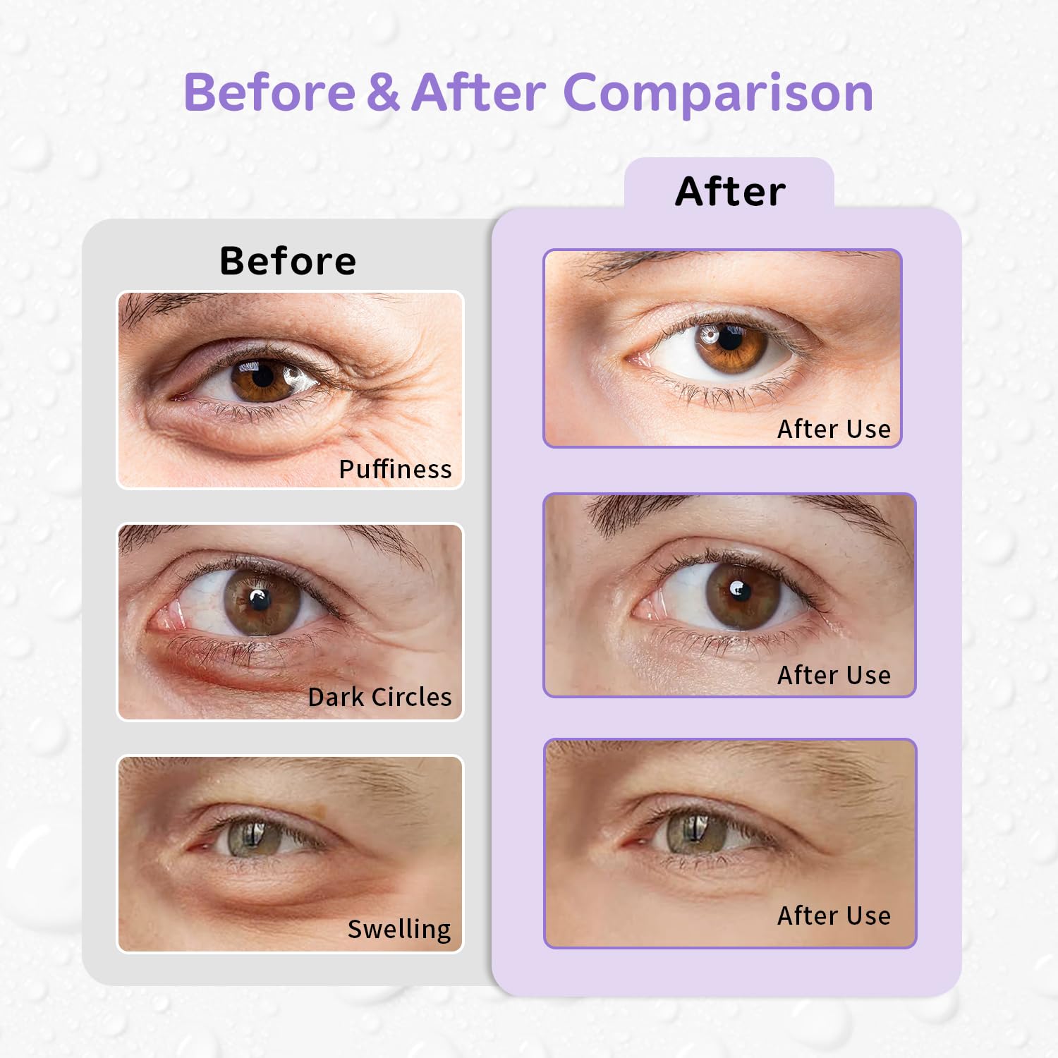 CONBELLA 4PCS Gel Eye Ice Pack Set, Cold & Hot Compress, Reusable Cooling Gel Pads for Strain Relief, Swelling, Dark Circles, Redness, Puffy Eyes, Surgery Recovery(4 Purple flowers)