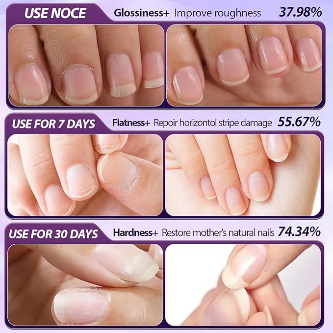 3-in-1 Cuticle Oil Pen, Cuticle Pusher, Nail Oil Pen with Ceramic Tip, Dry & Damaged Nails, Nail Cuticle Remover, Moisturize & Repair, 3PCS