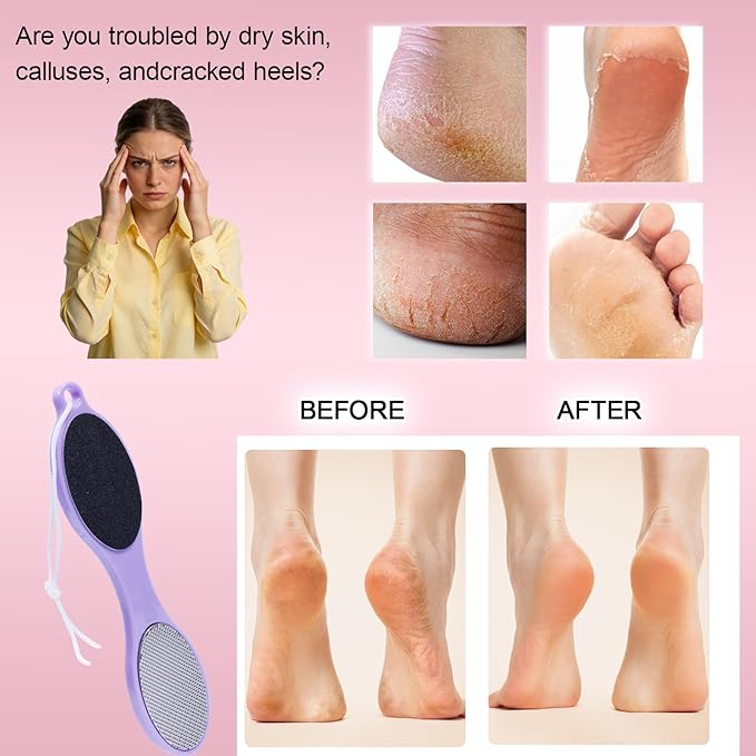 4-in-1 Nano Glass Foot Callus Remover, Professional Foot File (Glass, Rasp & Sand Paper), Durable Foot Scrubber Pedicure Tools for Hard Dead Skin Remover, Soft Smooth Feet, 2 Pcs Pink Purple