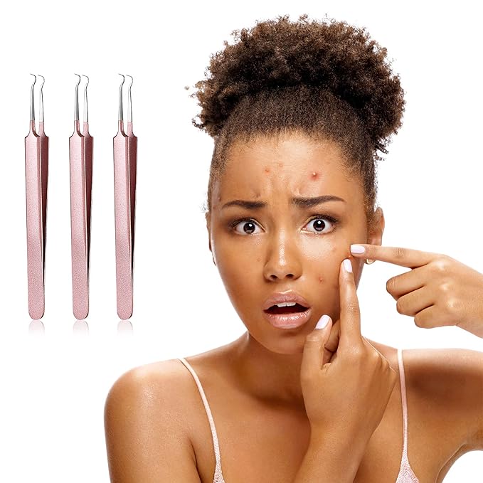 Honoson 3 Pcs Blackhead Tweezer Stainless Steel Pimple Tweezers Tool for Remove Zit Whitehead Pimple Bend Curved Extractor Tweezer Skin Blackhead Remover Tools(Champagne Purple)