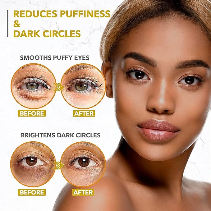 Under Eye Collagen Patches - 24K Gold Eye Mask Anti-Aging Hyaluronic Acid - Under Eye Mask for Reducing Dark Circles & Puffy Eyes (30 PAIRS) - Under Eye Bags Treatment