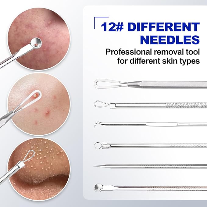 Blackhead Remover Pimple Popper Tool Kit 10PCS Professional Stainless Steel Blackhead Tweezers,Pimple Extractor for Removing Pimples, Zit on Face - Acne Removal Kit with Case Magnifier