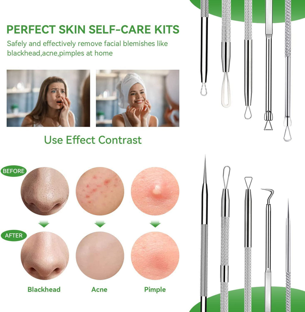 Pimple Popper Tool Kit,Blackhead Remover Tool 5 Pcs Blackhead Extractor Tool for Face Comedone Zit Acne Whitehead Blemish, Stainless Steel Extraction Tools Set