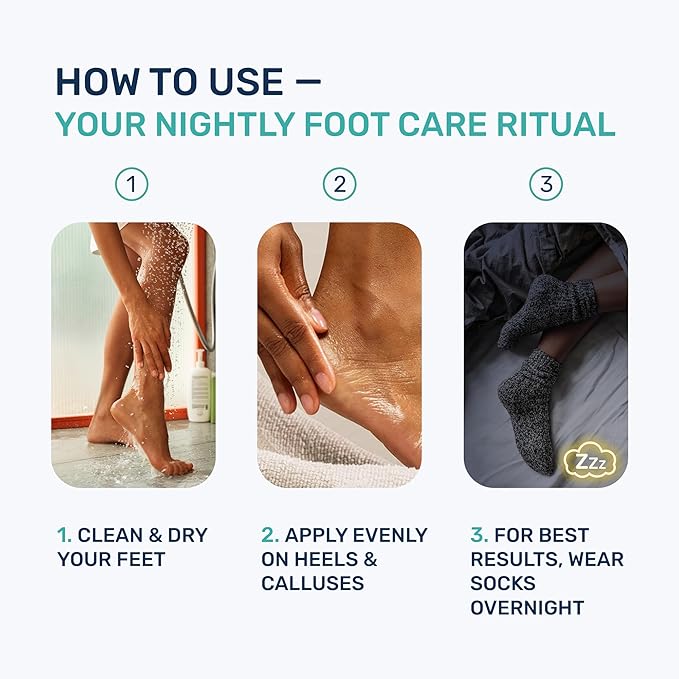 Urea Cream 40 Percent for Feet Maximum Strength, Callus Remover Foot Cream, Dry Cracked Heels Exfoliating Lotion with Salicylic Acid, Ceramides, Tea Tree Oil – Women and Men, 4.3 oz