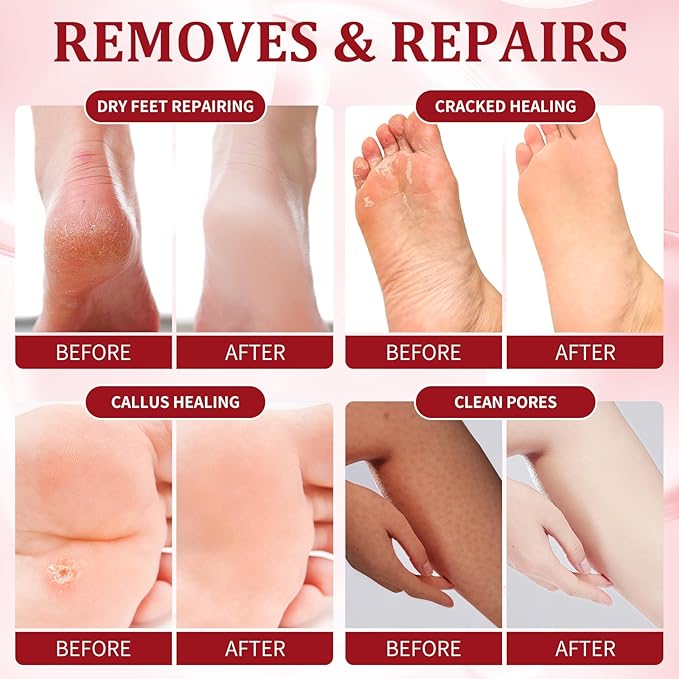 nbc BeautiLab Pedicure Kit Foot Soak Set: Bubble Salt, Sugar Scrub, Massage Mask, Massage Lotion in a Box, 4 Step Foot Spa Kit for Dry Feet,Tired Feet (1 Set Pomegranate)