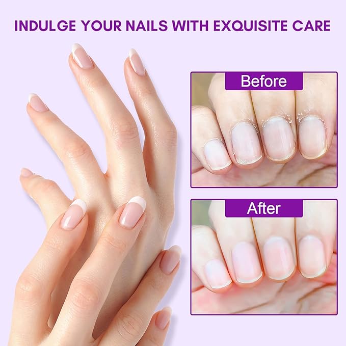 Makartt Cuticle Oil Pen Nail Care: Repair and Softener with Vitamin E, Moisturizer Kit for Acrylic Nails, Art Accessory for Manicure and Pedicure, DIY Home Salon Use