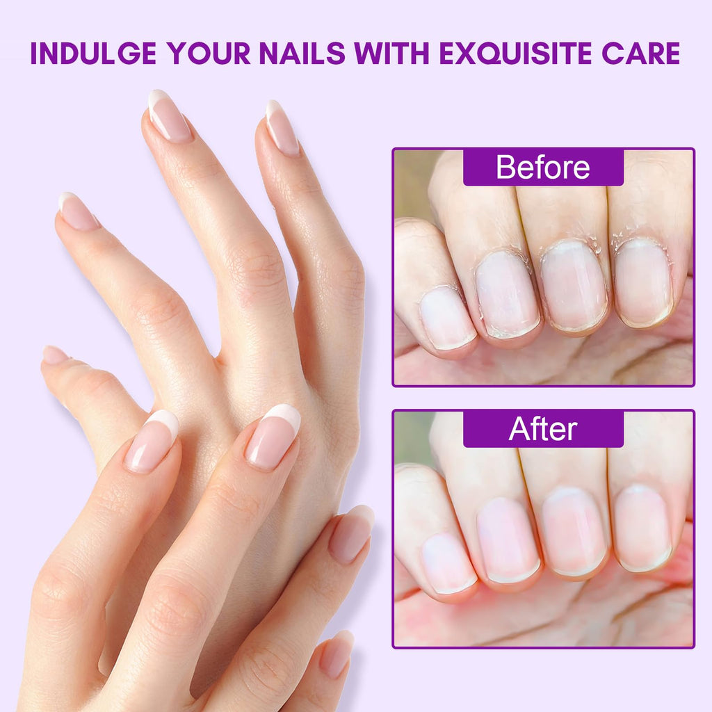 Makartt Cuticle Oil Pen Nail Care: Repair and Softener with Vitamin E, Moisturizer Kit for Acrylic Nails, Art Accessory for Manicure and Pedicure, DIY Home Salon Use
