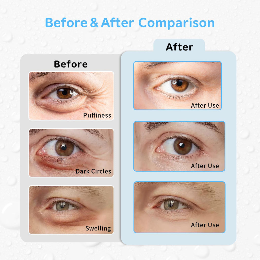 Conbella 4PCS Gel Eye Ice Pack Set Reusable, Cold and Hot Compress for Eyes