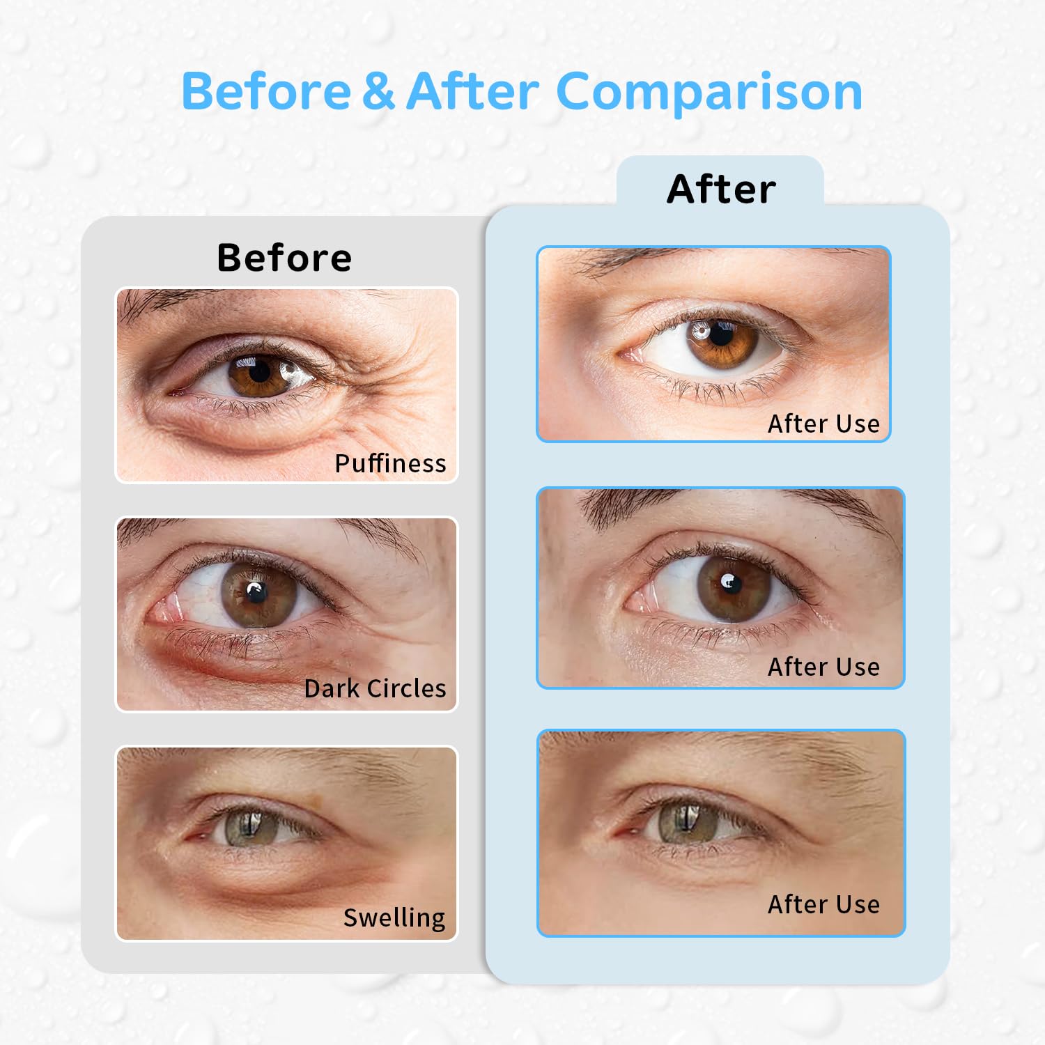 Conbella 4PCS Gel Eye Ice Pack Set Reusable, Cold and Hot Compress for Eyes
