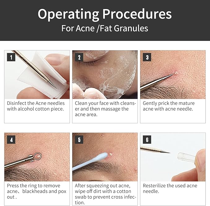 GERY Blackhead Remover Pimple Popper Tool Kit, 8 PCS Professional Stainless Steel Acne Needles, Comedone Extractor Whitehead Removal, Zit Popping Treatment & Pore Cleaner Set with Leather Case
